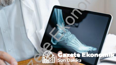 akciğer grafisi nasıl çekilir